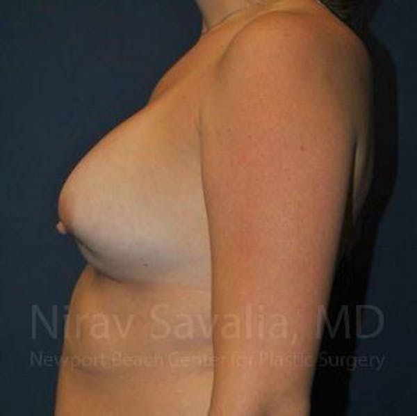  Before & After Gallery - Patient 1655486 - Before1