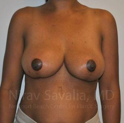 https://drsavalia.com/gallery-images/1572046539-1c96eb2a-29a2-411a-ab4f-61640100f503.jpg
