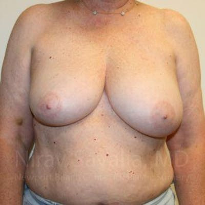 https://drsavalia.com/gallery-images/1572046592-18facfea-26f8-4822-90c9-c0ae731f9d9b.jpg