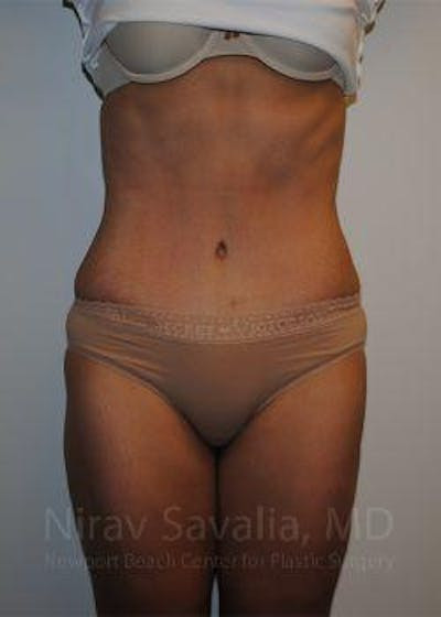 https://drsavalia.com/gallery-images/1572056343-a26ff048-95dd-480c-90be-8c9eaa7d1a88.jpg