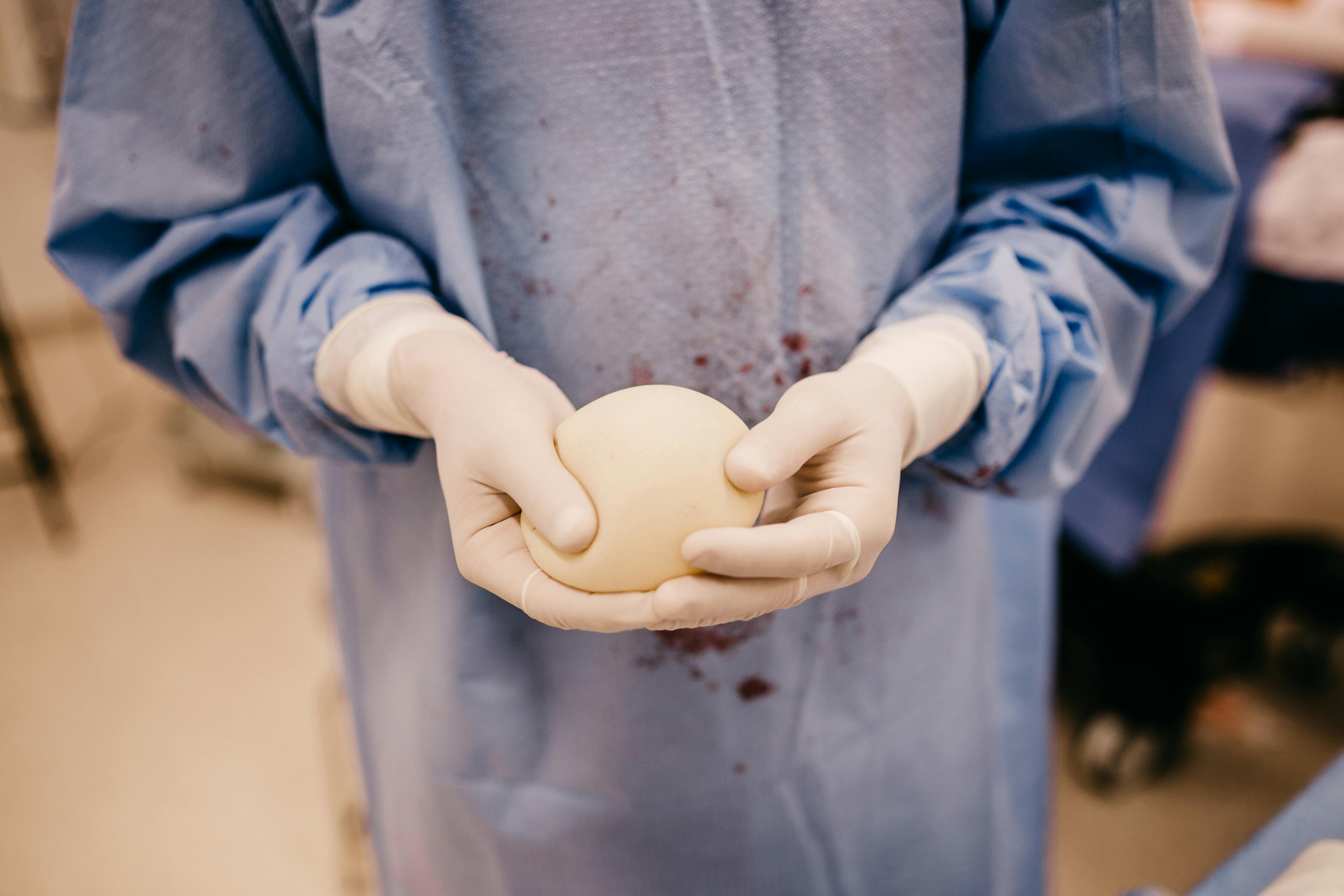 Choosing Implant Placement: Submuscular vs. Subglandular