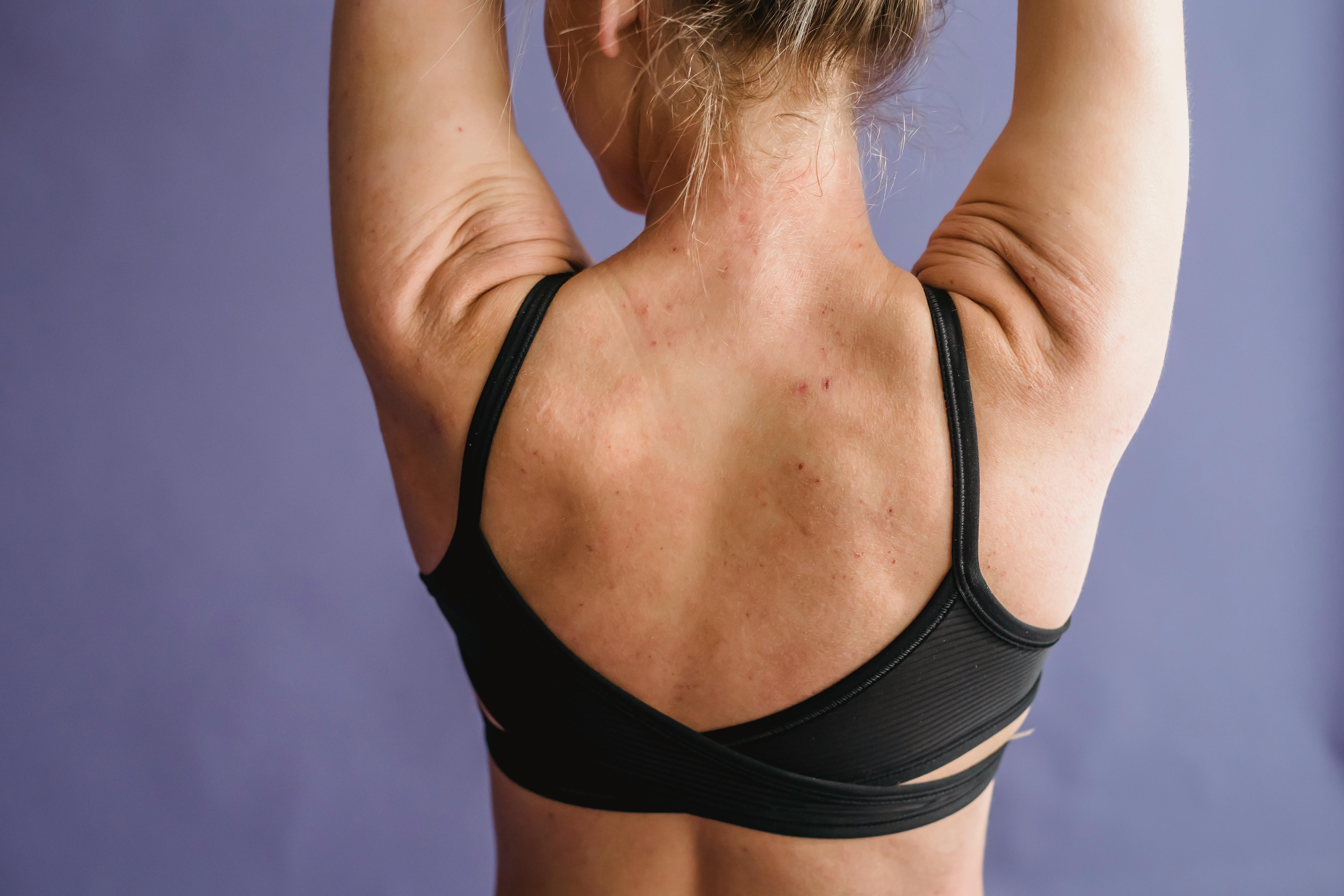Bra-Line & Upper Back Lift: Hidden Sculpting Under Your Clothes