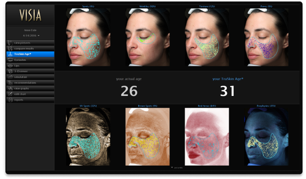 visia skin age analysis