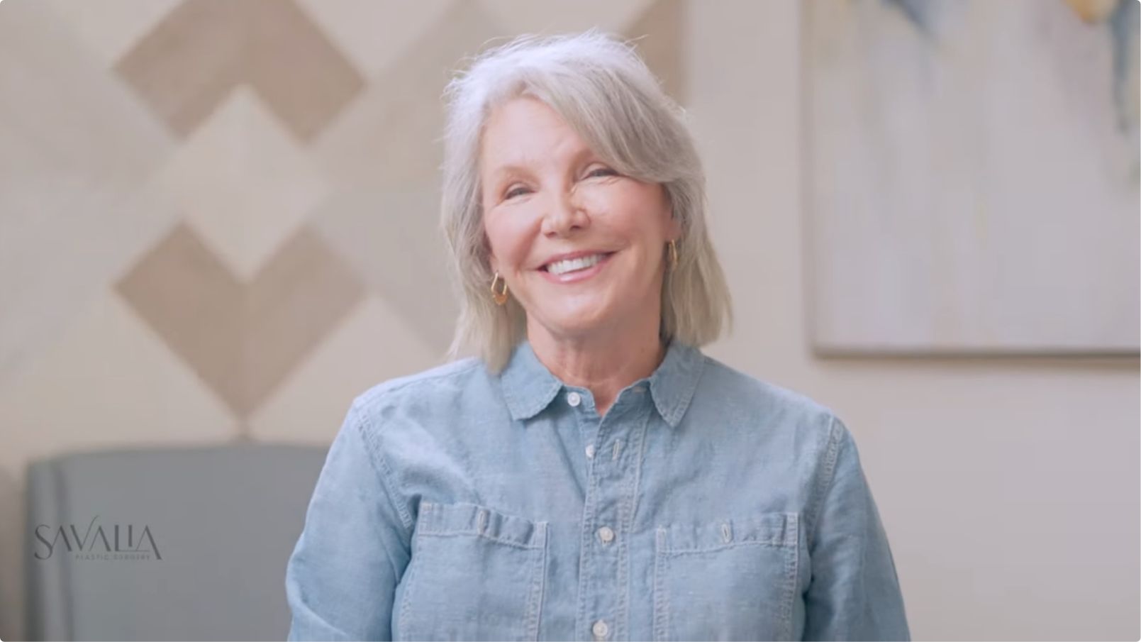 Video story - facelift